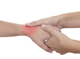 Artritis: Qué es y cómo tratarla naturalmente