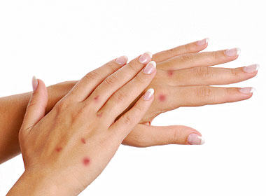 10 señales de la piel a las que prestarle atención